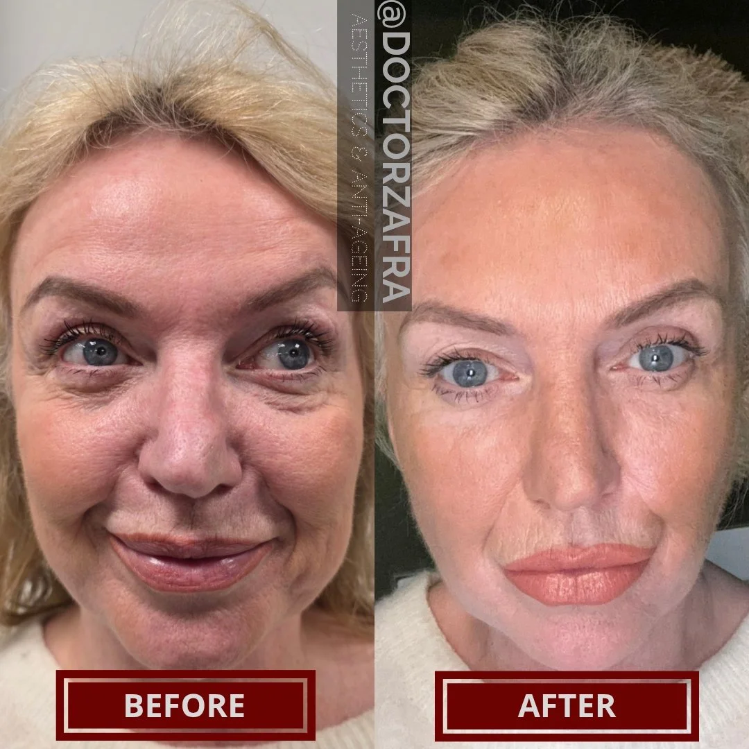 Ageing-Rejuvenated_20260122_180913_0000.jpg