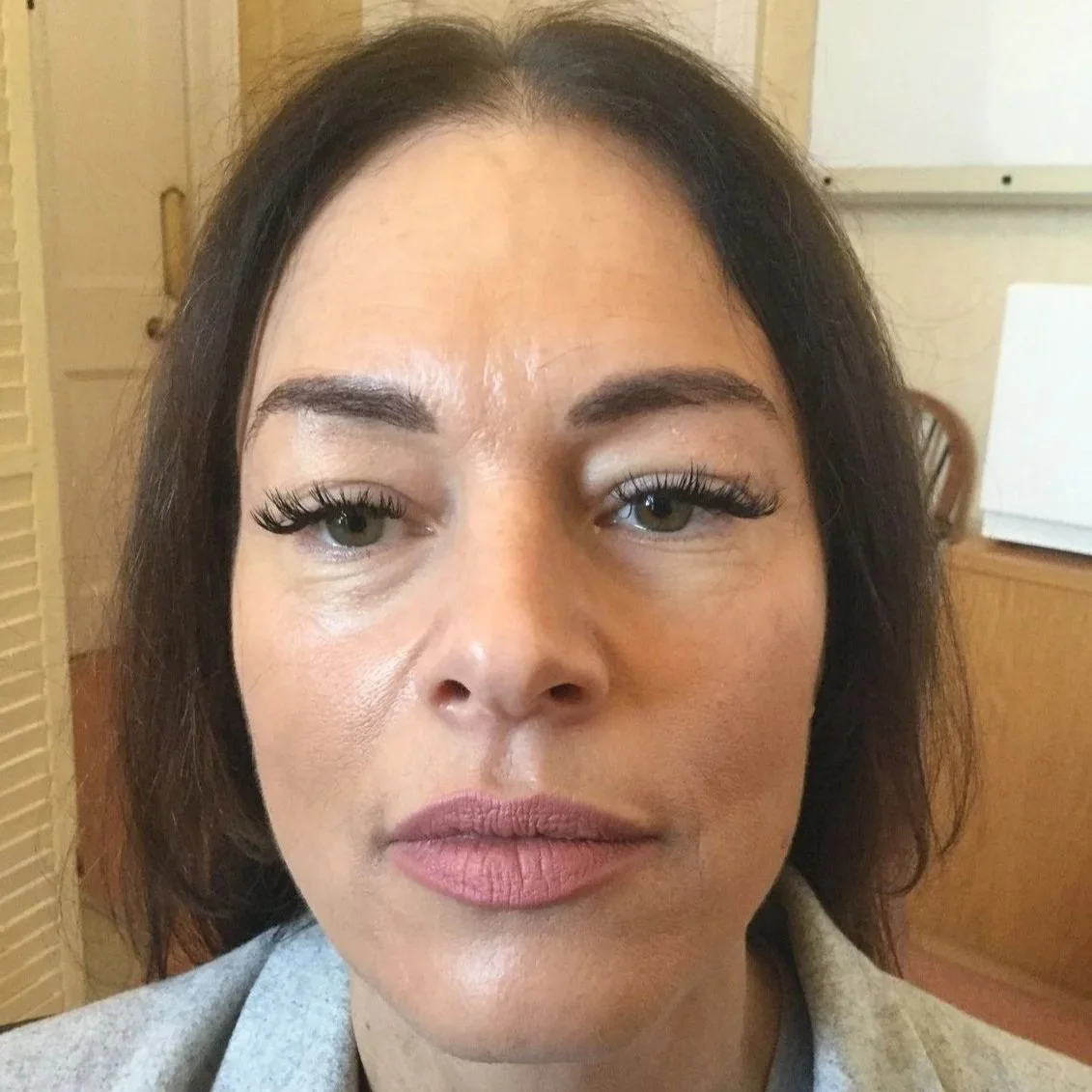 co2-laser-facial-rejuvenation-before-woman-face-3.jpg