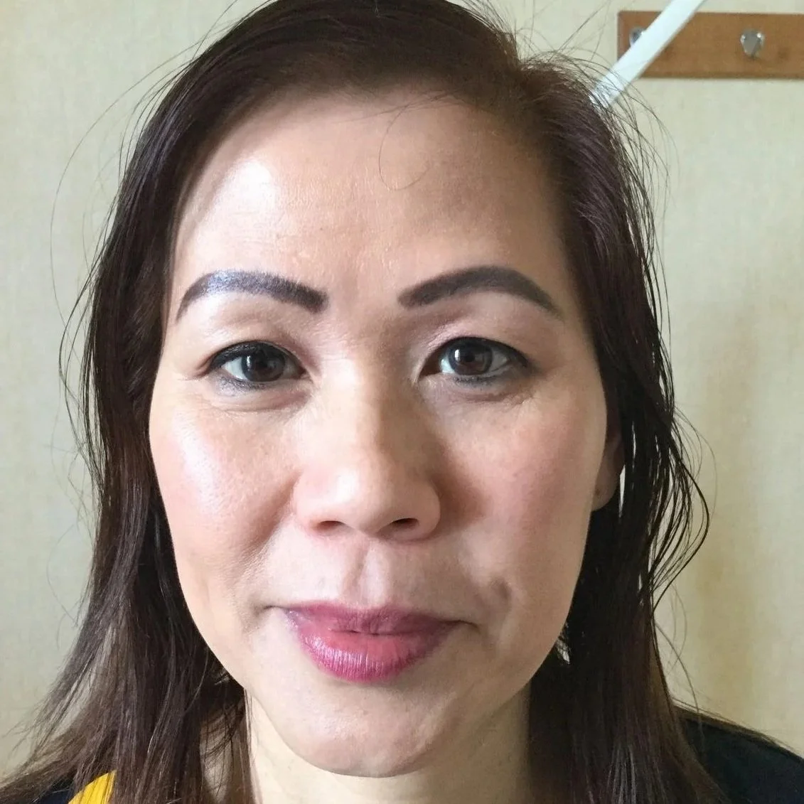 co2-laser-skin-treatment-before-woman-face-6.jpg