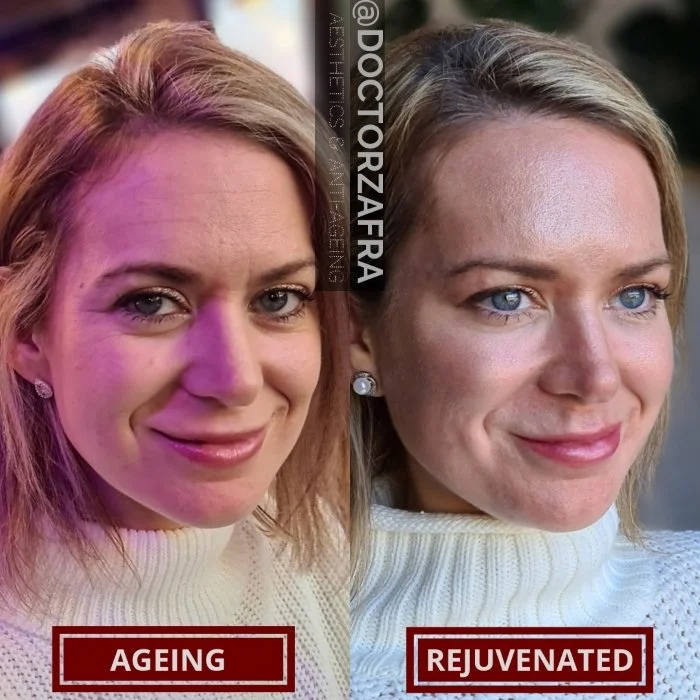 2a Bespoke Rejuvenation Treatment Plan.jpg