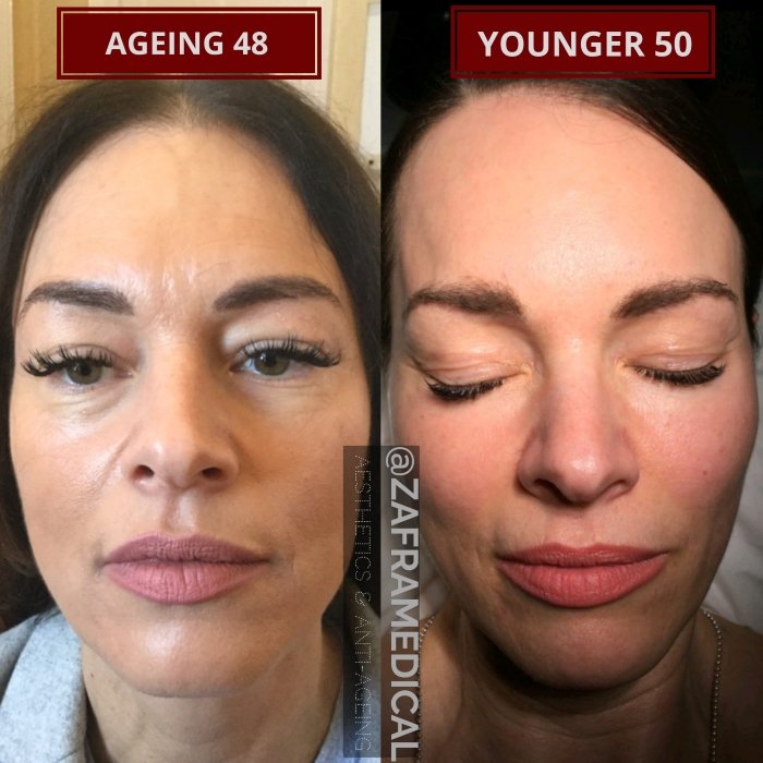 3a Bespoke Rejuvenation Treatment Plan.jpg