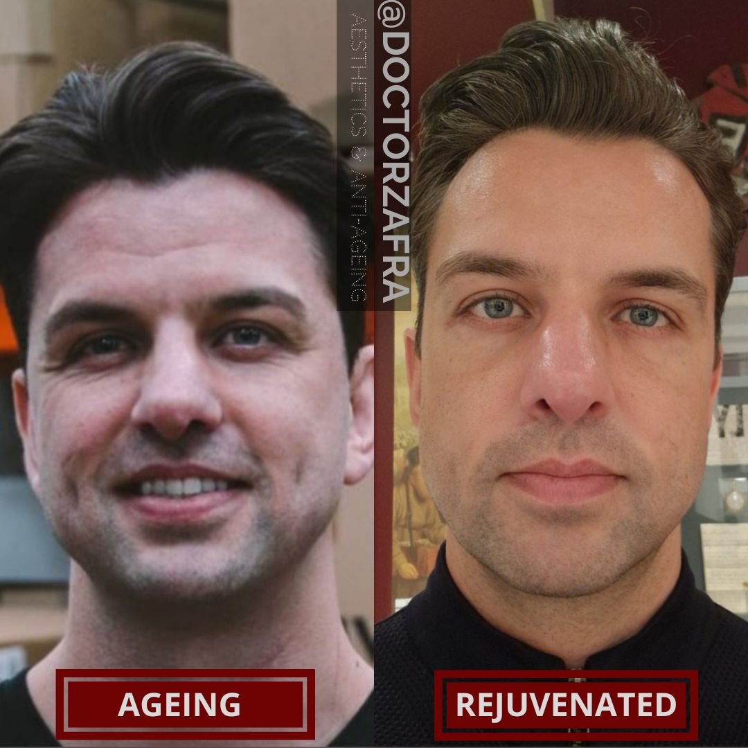 4 Bespoke Rejuvenation Plan for Man.jpg