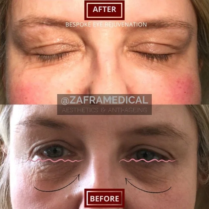 4 Bespoke Rejuvenation Plan for Woman.jpg