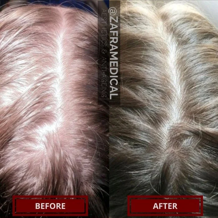 Hair Growth treatment.jpg