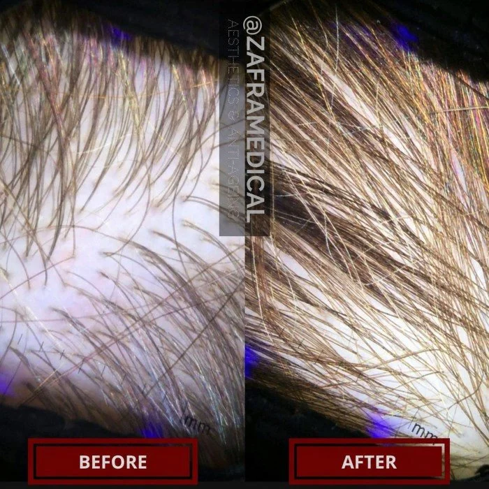 Hair Growth Treatment 2.jpg