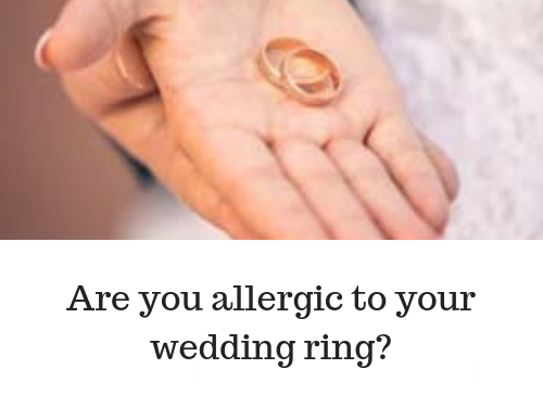Are you Allergic to Your wedding Ring?