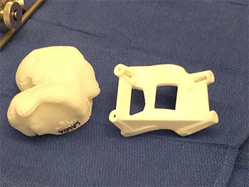 PSI – Bone Model & Guide