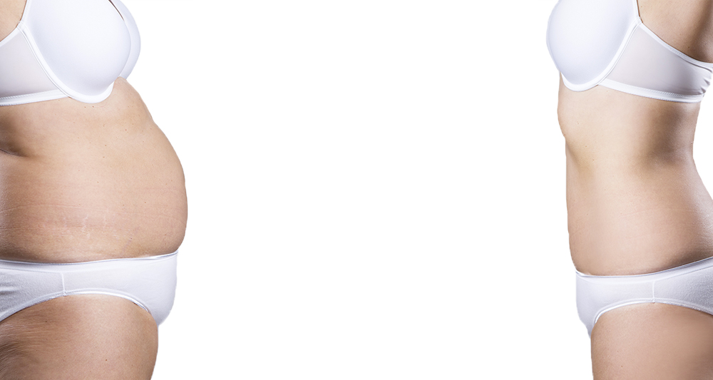 Book-Your-Transformation--Header--Sobella.jpg