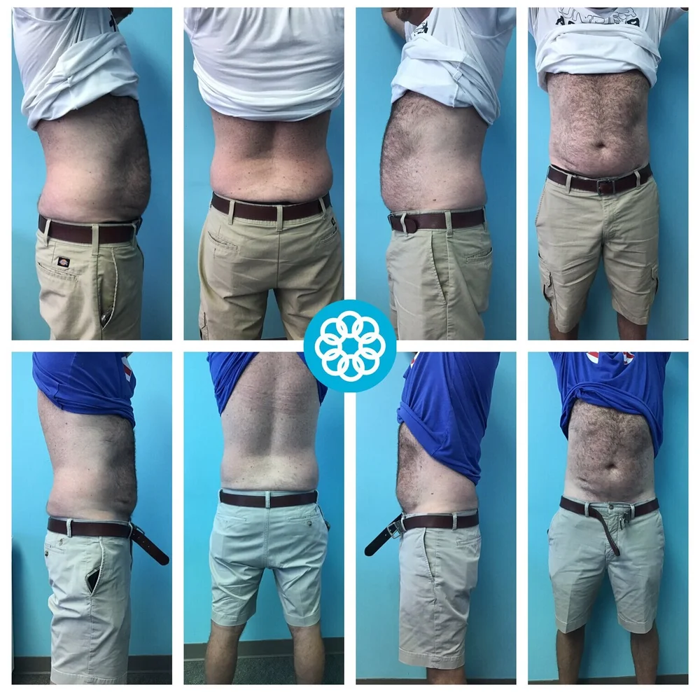 Sobella — Before & After