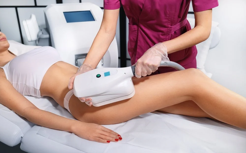 Cryolipolysis Body