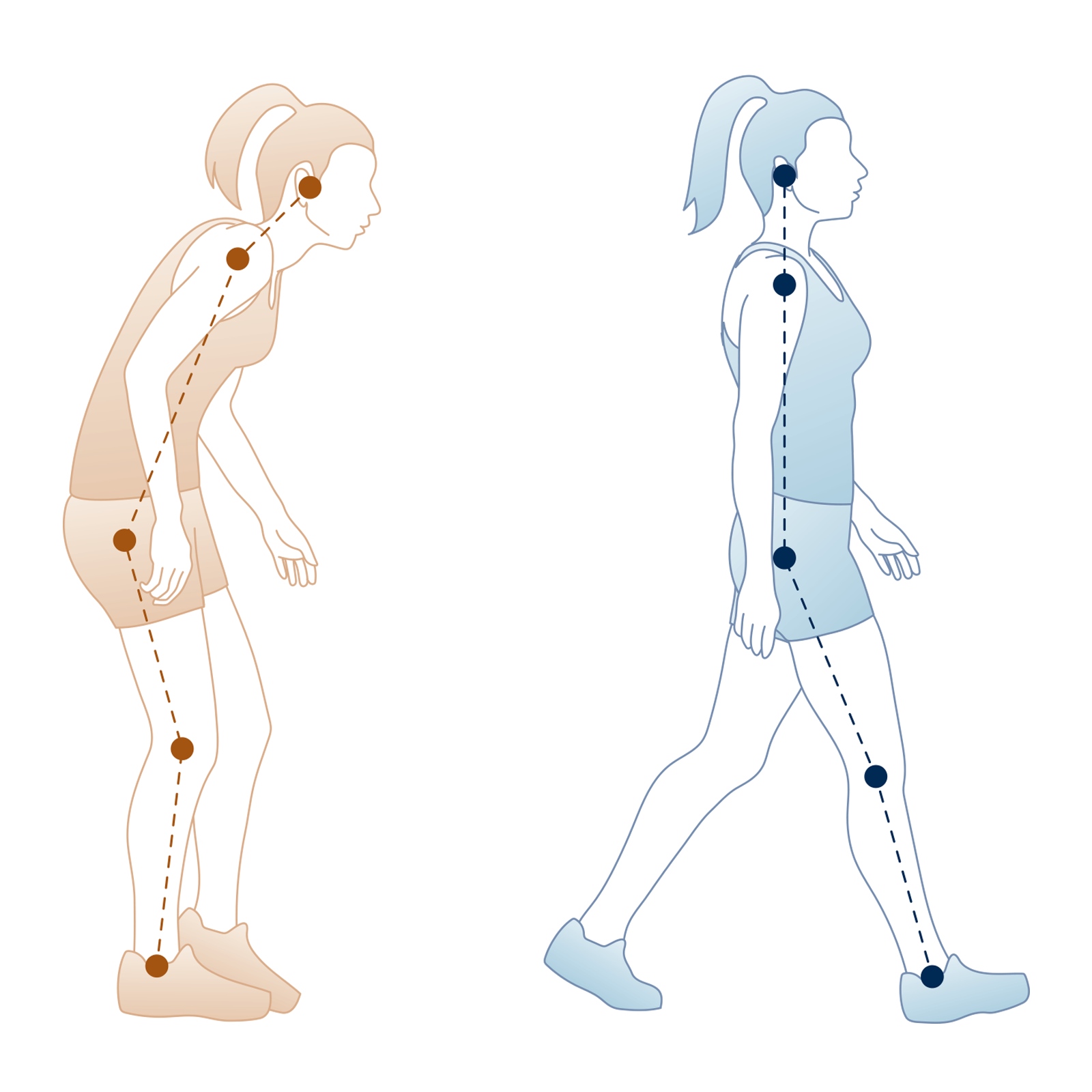 The Low Back Pain Walk