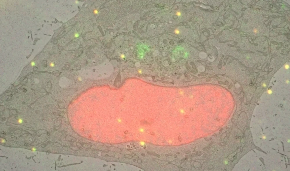 CLEM_nucleus-golgi.jpg