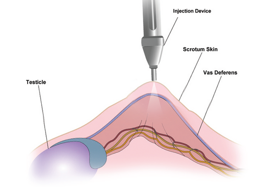 MADAJET Anaesthetic Delivery.