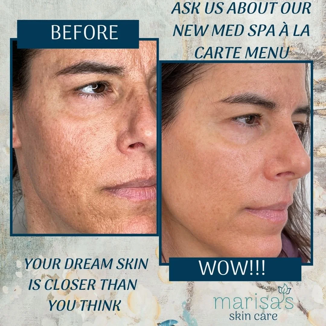 Ask us about our new Med Spa &agrave; la carte menu, treatment packages, or flexible financing options&mdash;your dream skin is closer than you think.The Before-and-Afters You&rsquo;ve Been Dreaming Of&mdash;Now Within Reach ✨
We&rsquo;ve customized 