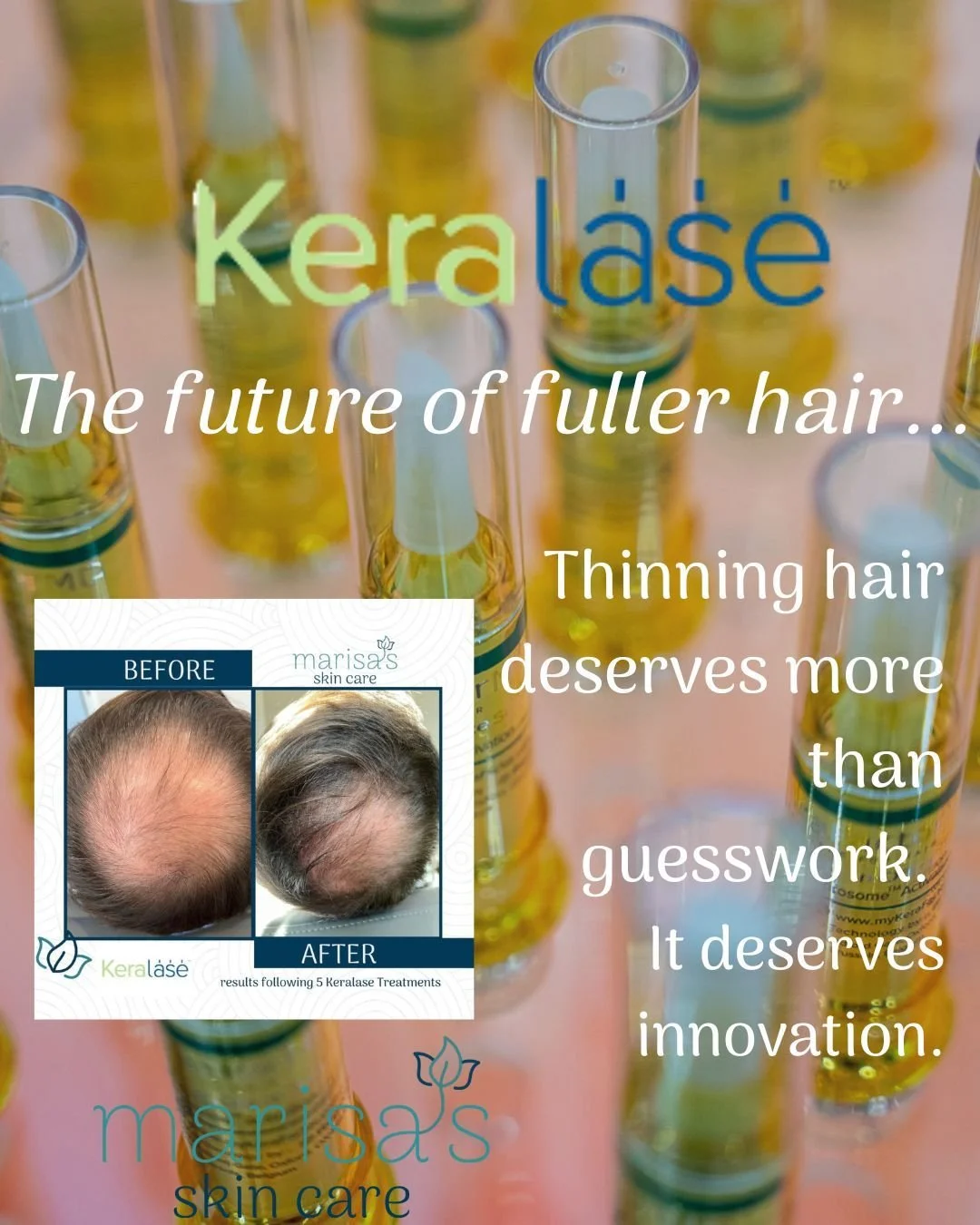 Thinning hair deserves more than guesswork. It deserves innovation.

At Marisa&rsquo;s Skin Care, we combine the precision of the Ultra laser with the power of KeraFactor serum to create the ideal environment for growth &mdash; right at the root.

Th