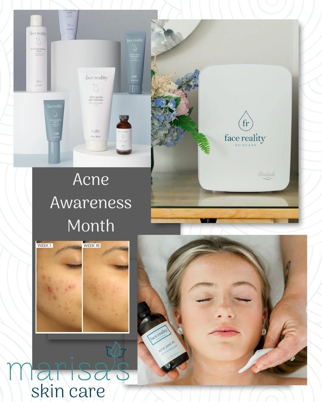 Acne Is More Than &ldquo;Just A Breakout&rdquo;
June is Acne Awareness Month, and at Marisa&rsquo;s Skin Care, we want you to know one thing&hellip; you are not alone. 
Acne affects confidence, emotions, social events, photos, and sometimes even the 