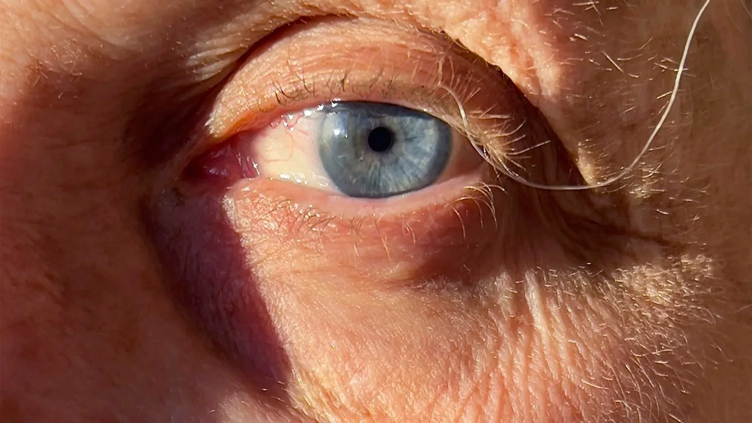 A Broken Tooth Started Lauren Shaw’s Photobook About Her Changing Body