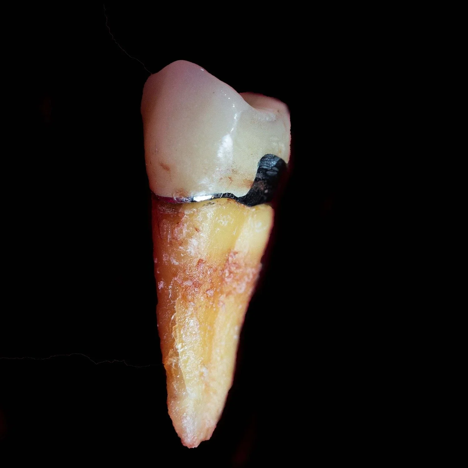 lauren-shaw-tooth.jpg