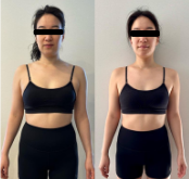 Before and after copy 2.png