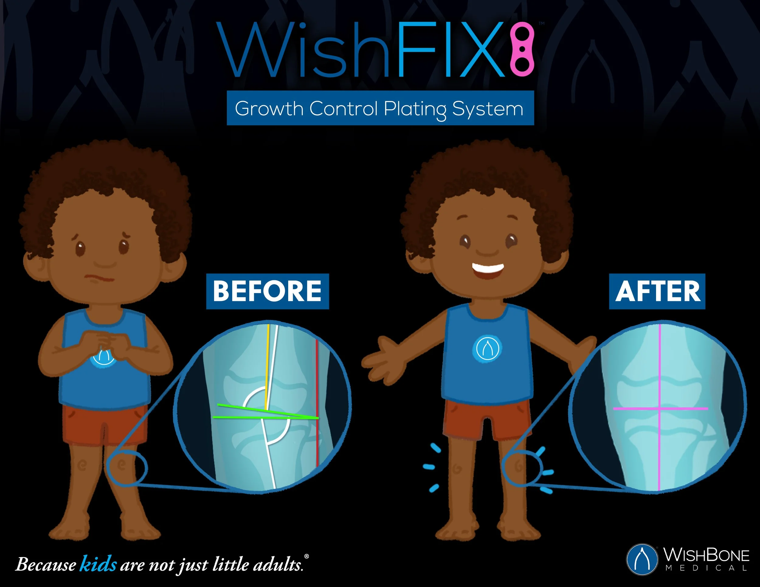 LI_WishFIX_XRay_02 copy.jpg