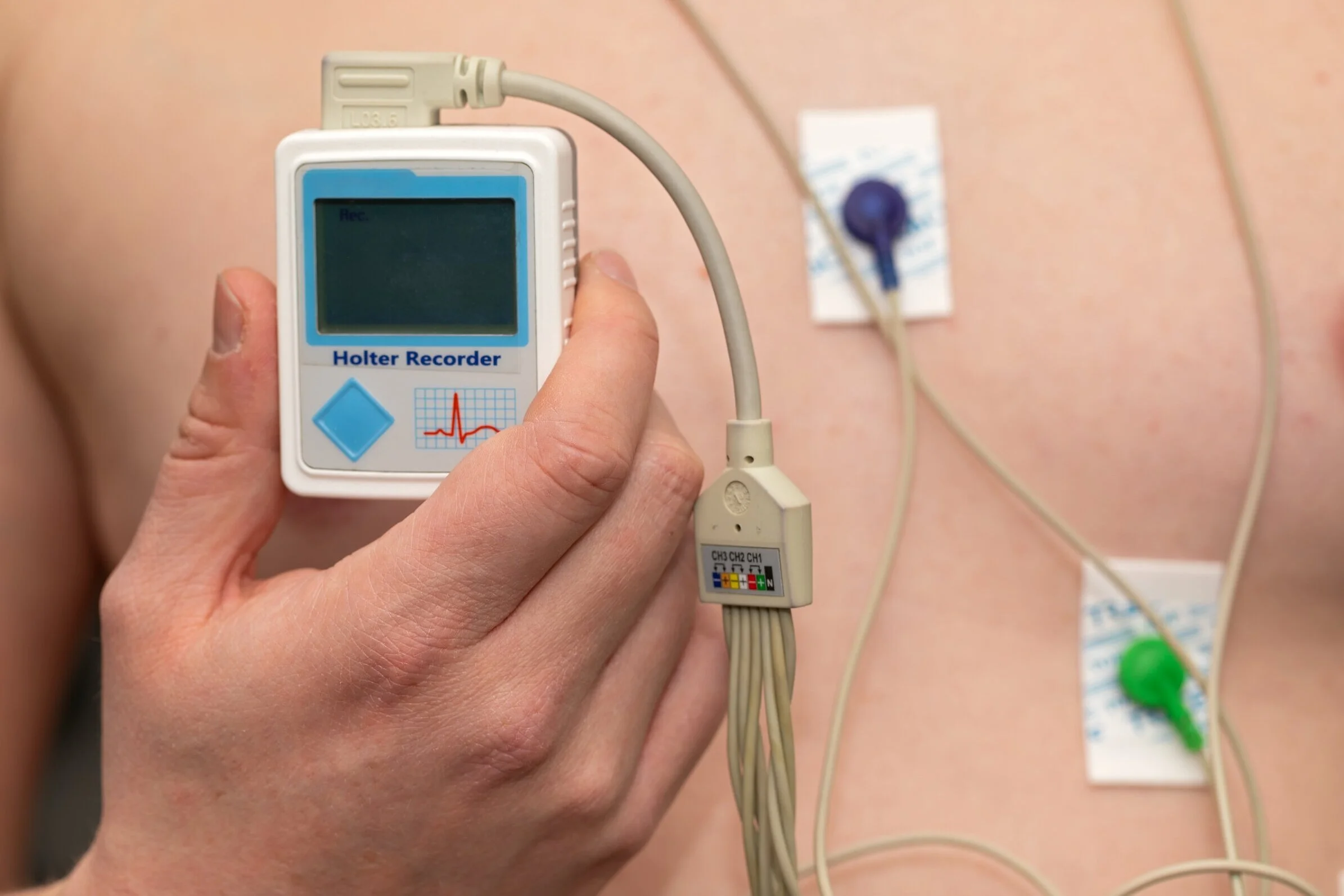 How Is AFib Diagnosed? — Dr. AFib™