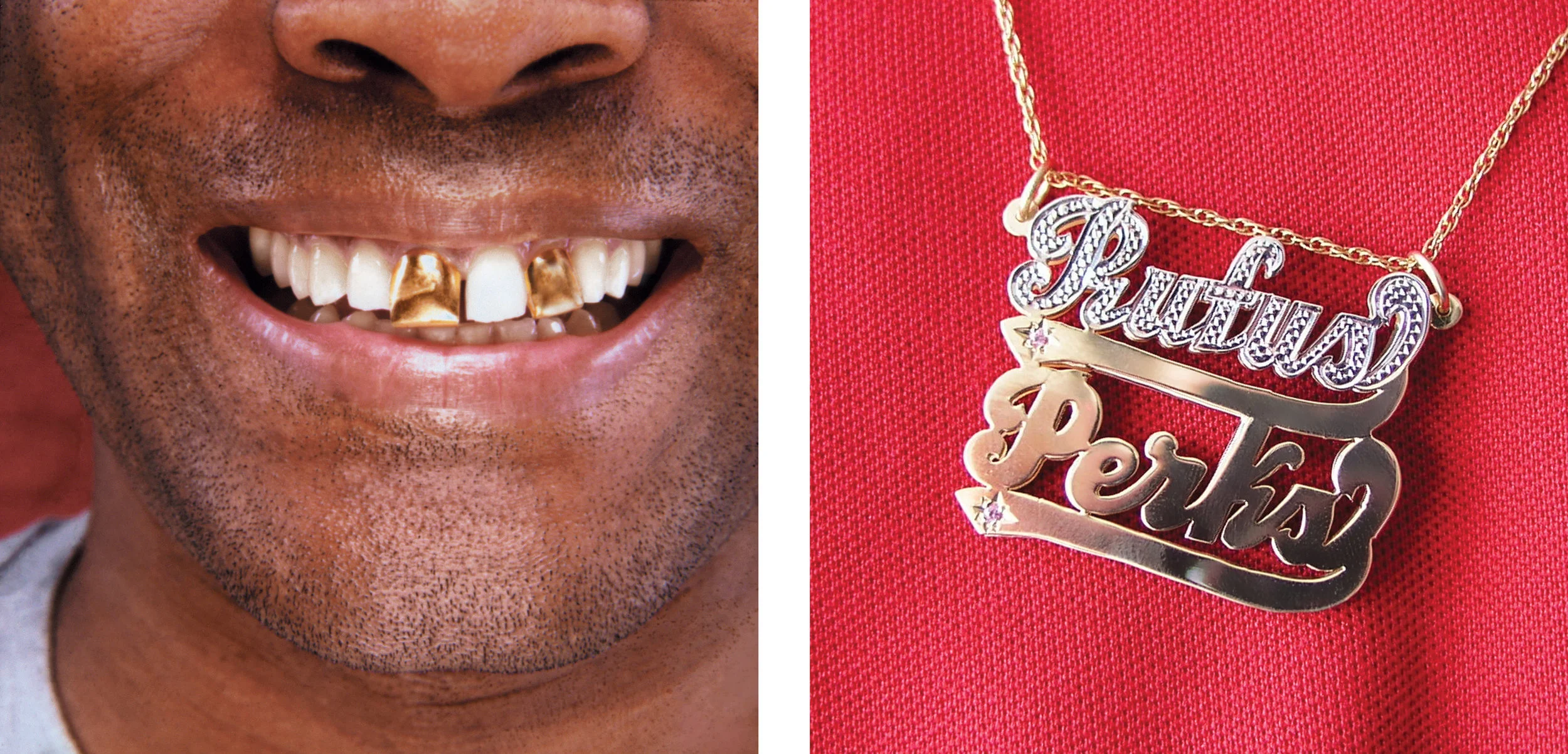 Gold_Tooth_Cap_And_Bling.jpg