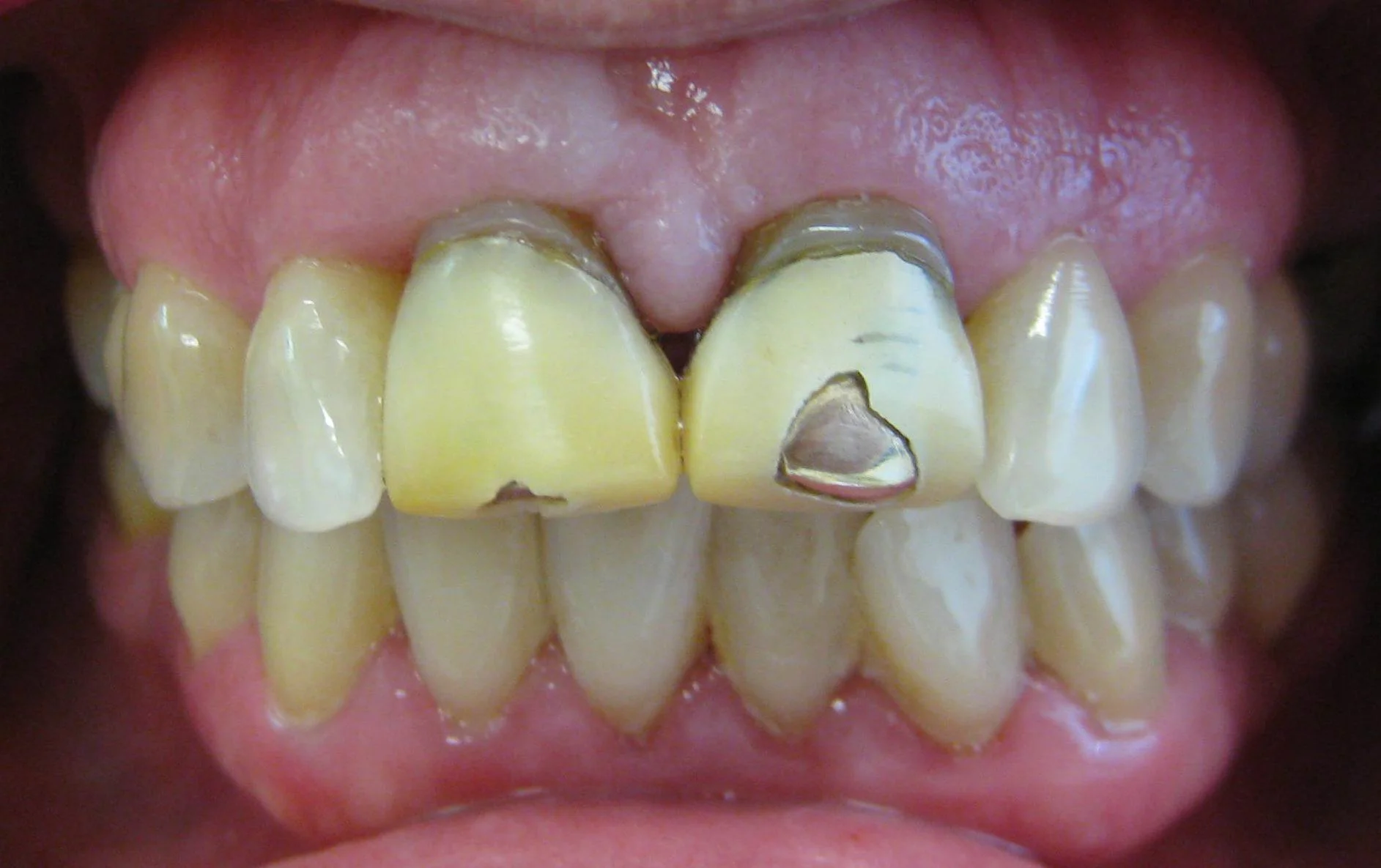 IMG_1098_c_before.jpg