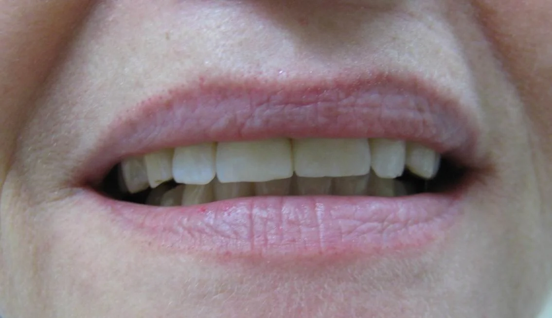 2_IMG_8869_After_Closure_smile_c.jpg