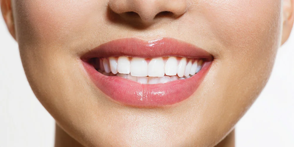 Teeth-Whitening-banner.jpg