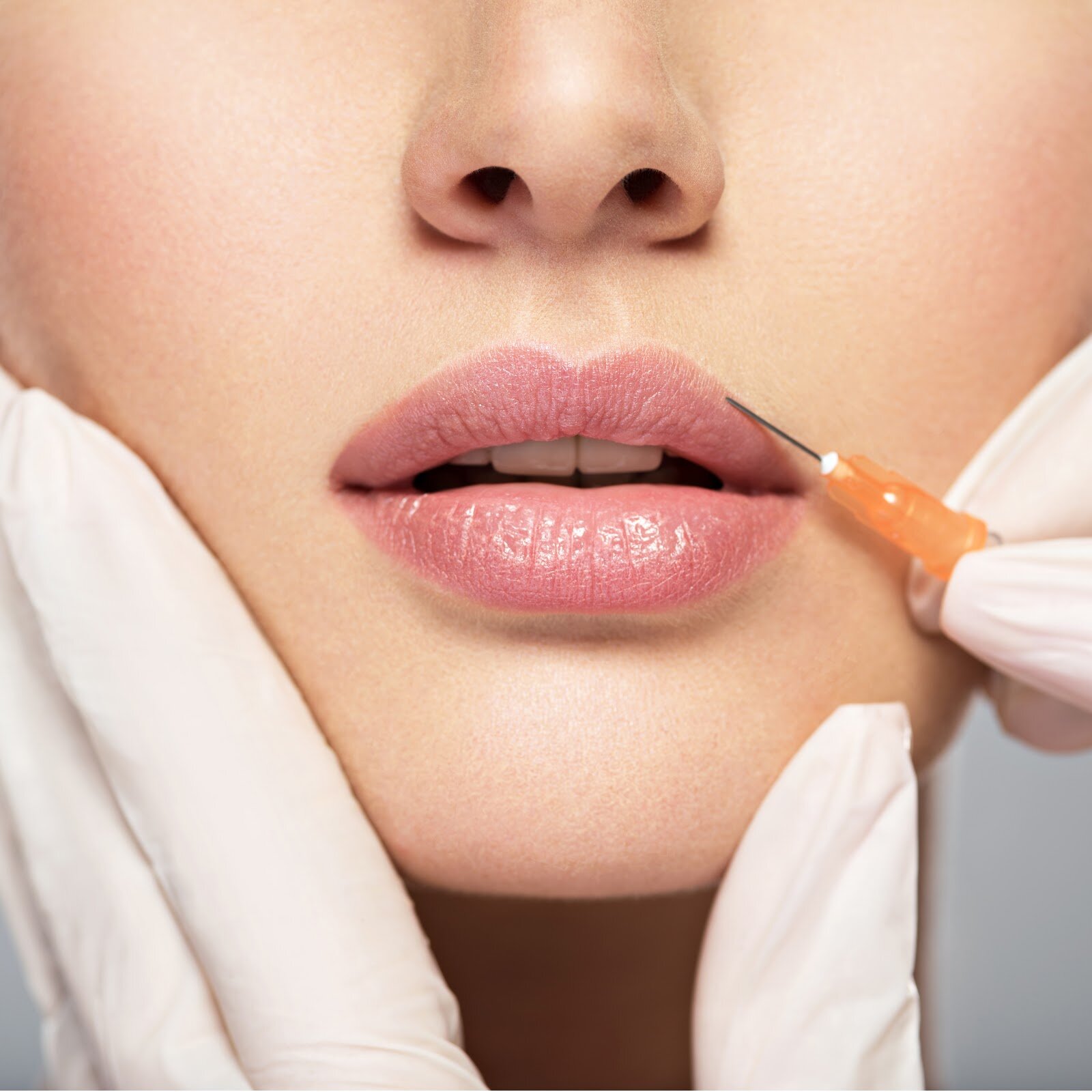 Dermal Filler Aftercare Tips