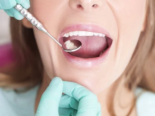 dental-filling.jpg