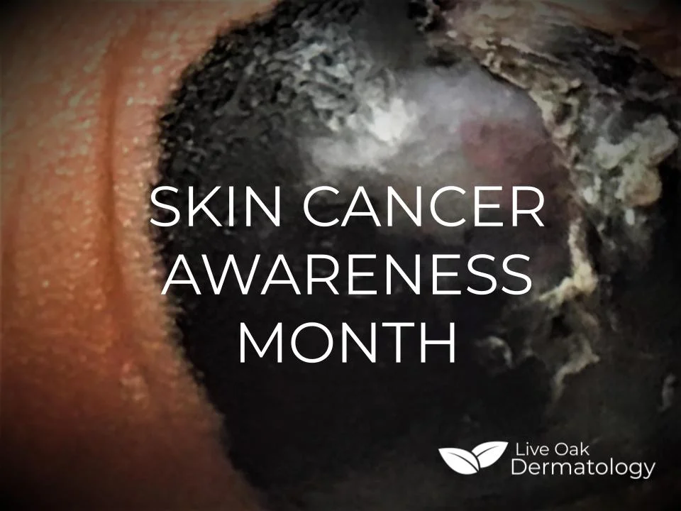 Skin Cancer Awareness Month.jpg