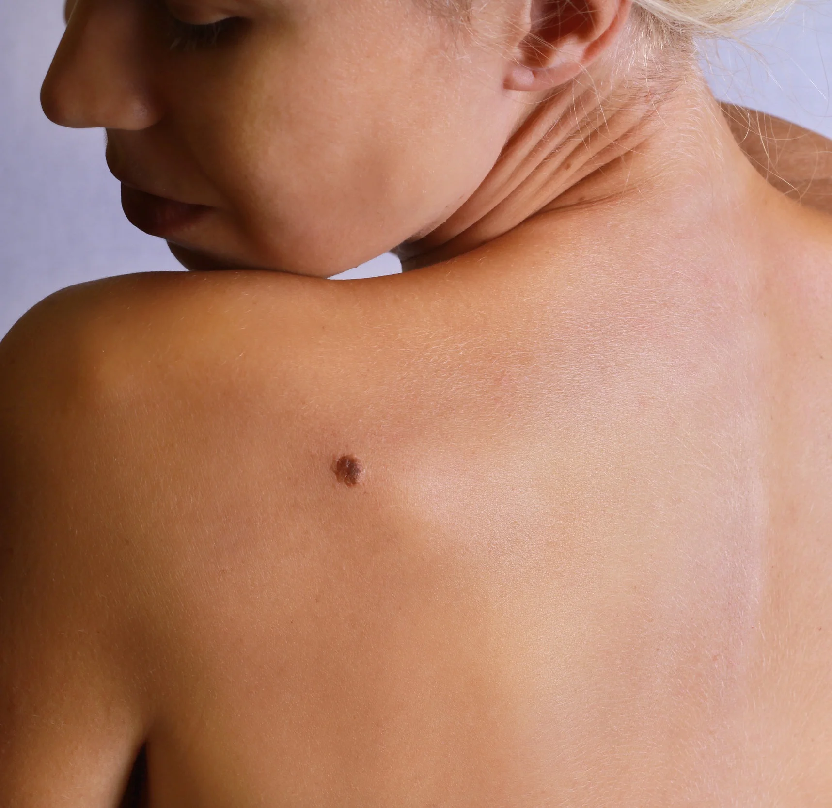 selfskincheck.jpg