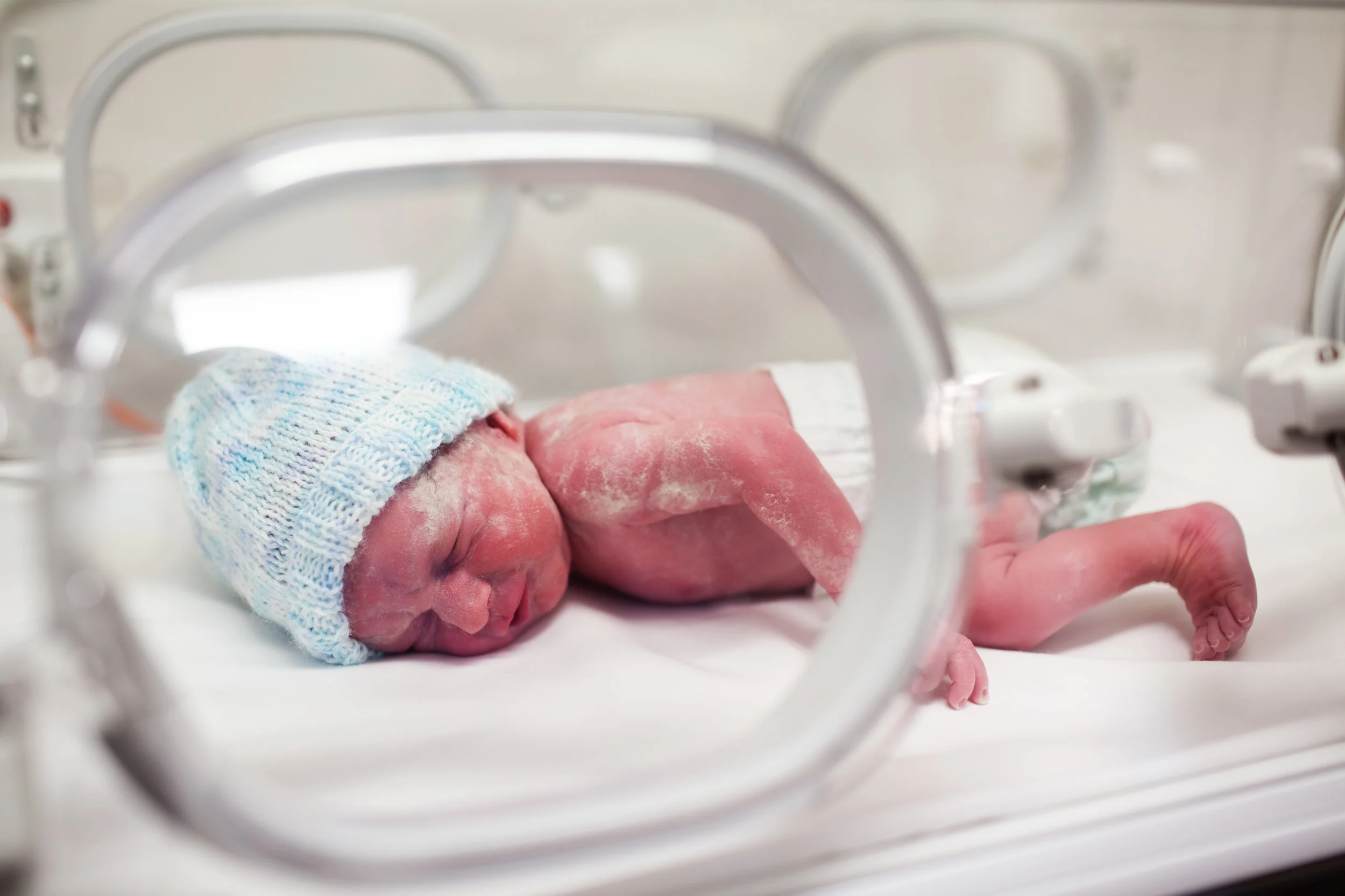 newborn-baby-covered-in-vertix-in-incubator-PRWKE7P.jpg