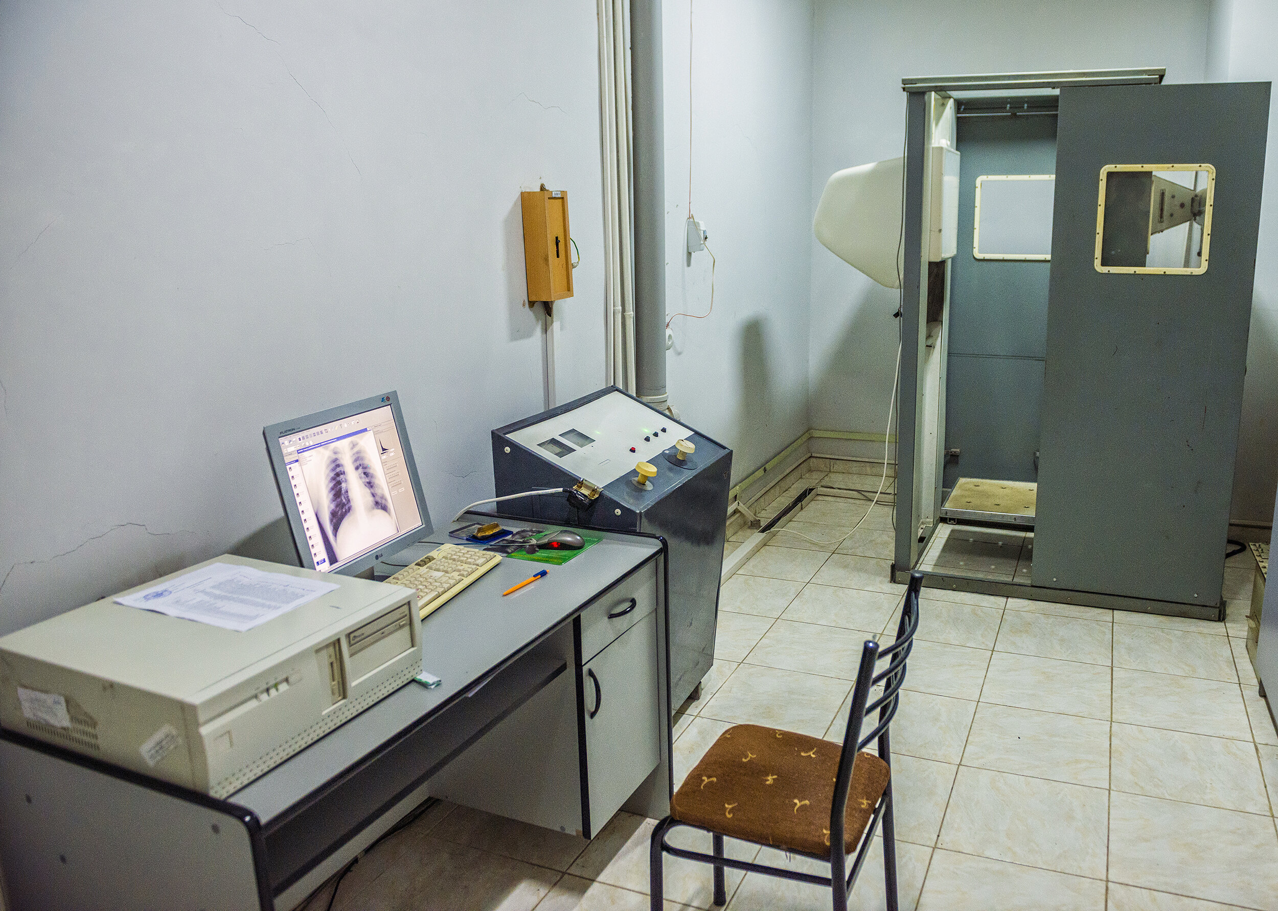  An X-ray machine stands with a monitor showing a patient’s chest at Stepanakert Central Military Hospital in Nagorno-Karabakh.  Stepanakert was besieged and fiercely bombarded for months during the 1992 Nagorno-Karabakh War. Over two decades later, 