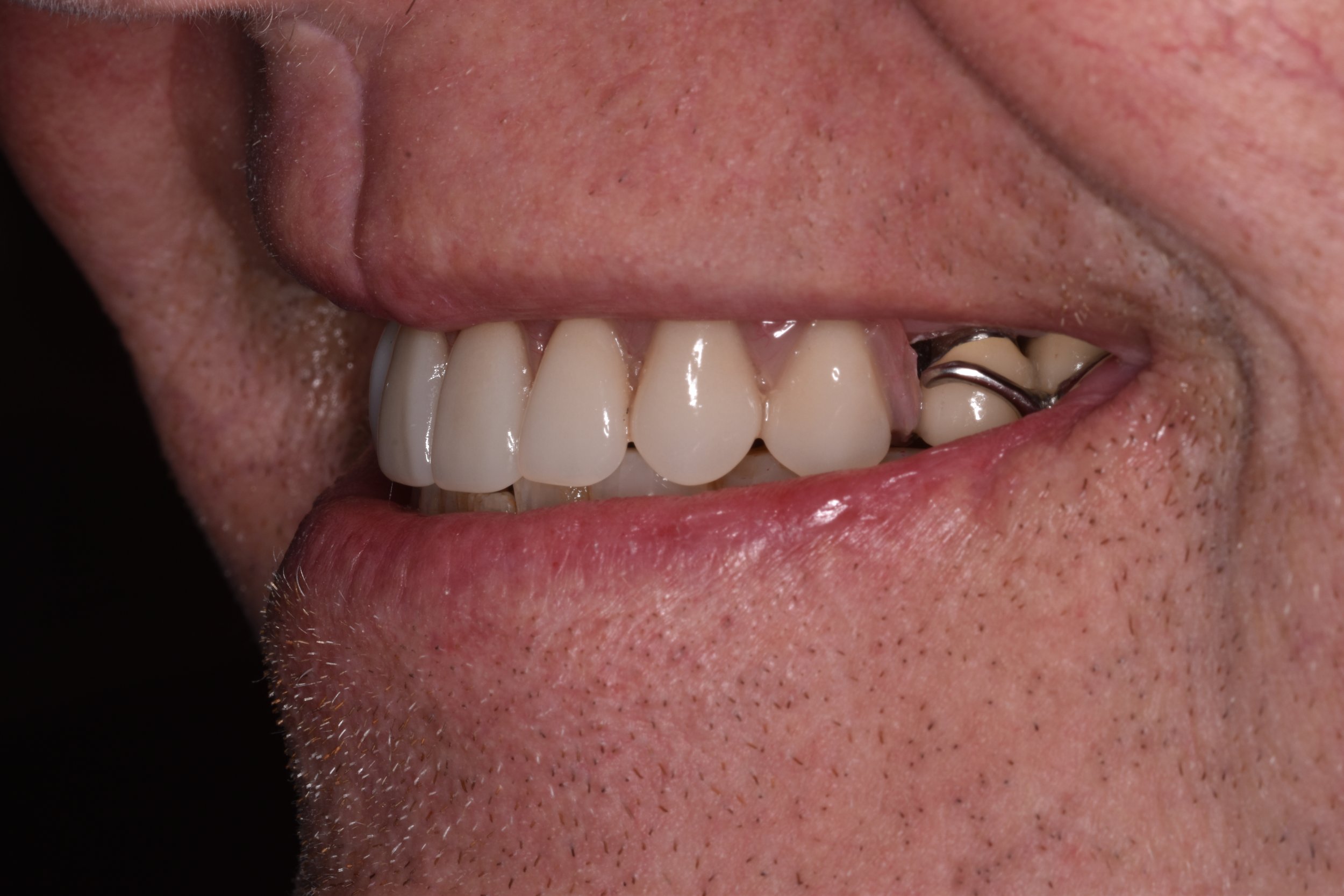 DSC_1039.JPG