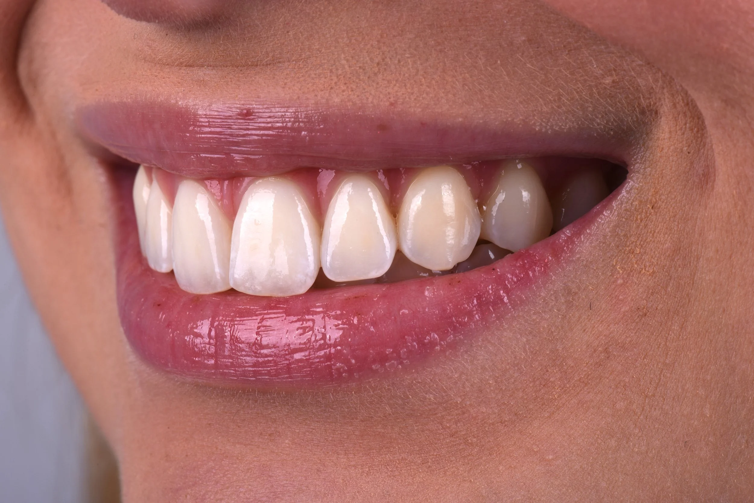 Cosmetic Dentistry — Texas Dental Solutions