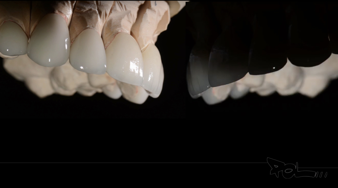 Cosmetic Dentistry New Jersey