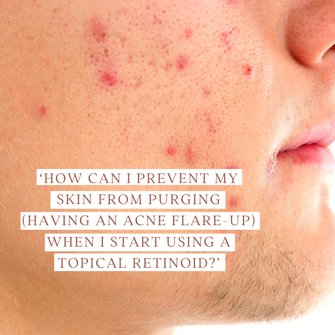 ‘How can I prevent my skin from purging (having an acne flare-up) when I start using a topical retinoid?’