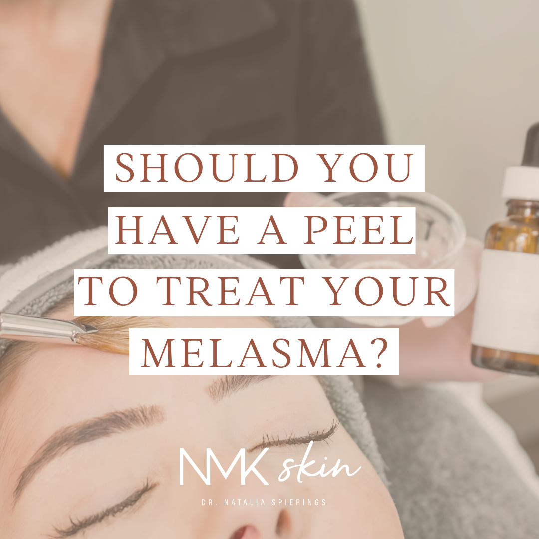 Should you have a peel to treat your melasma?