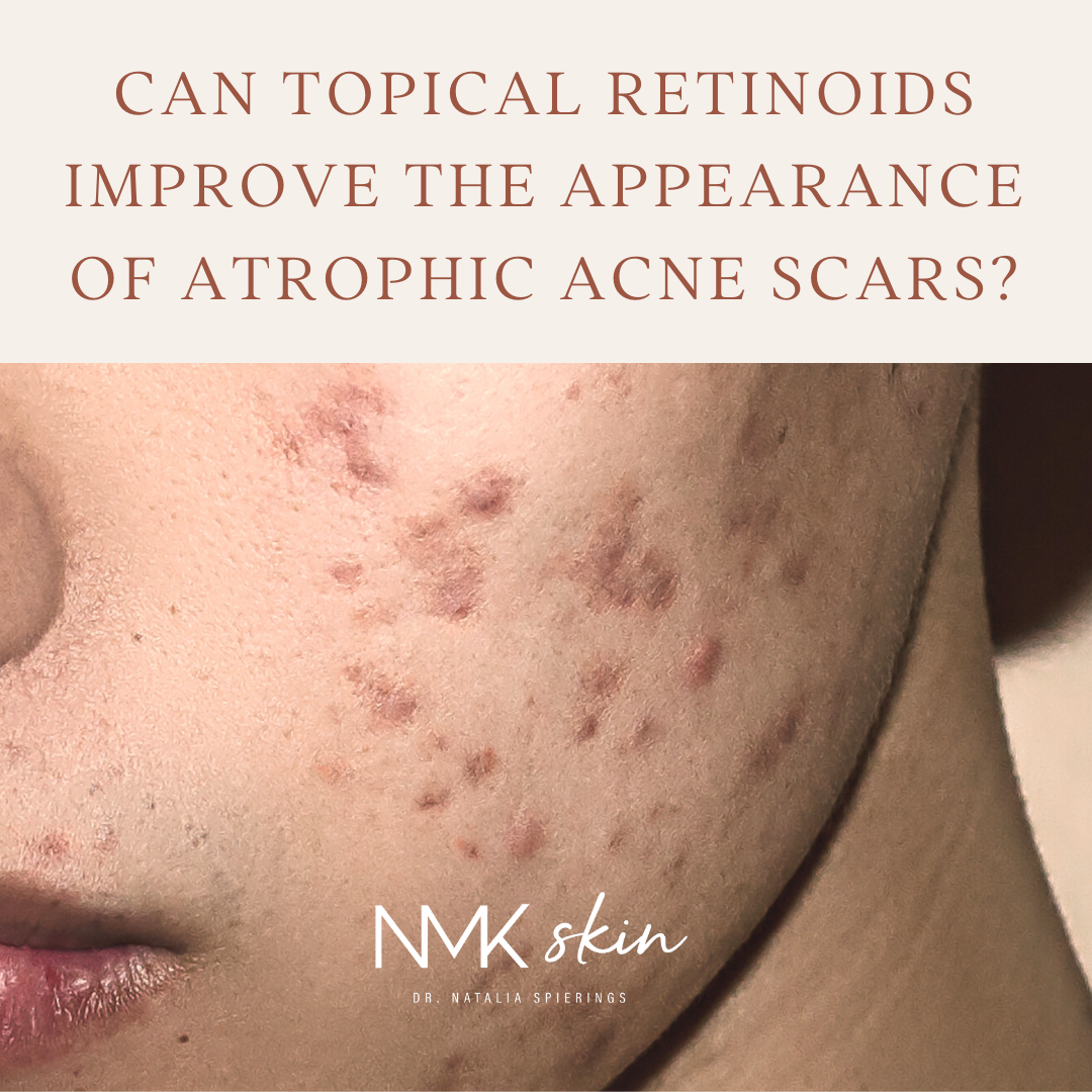Can topical retinoids improve the appearance of atrophic acne scars?