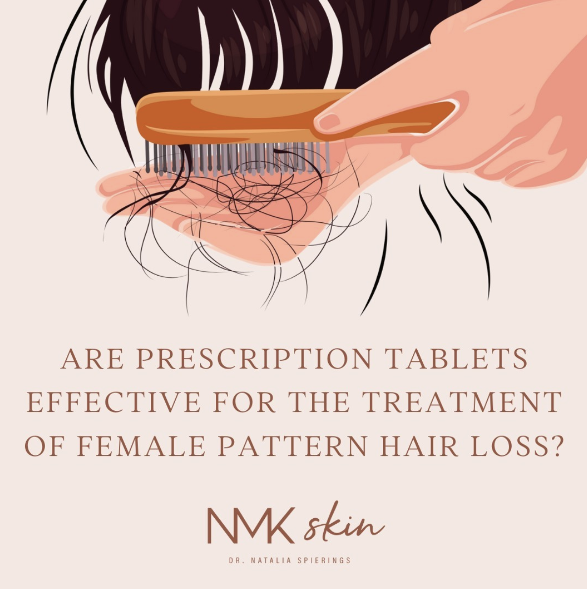 Are Prescription Tablets Effective for the Treatment of Female Pattern Hair Loss?