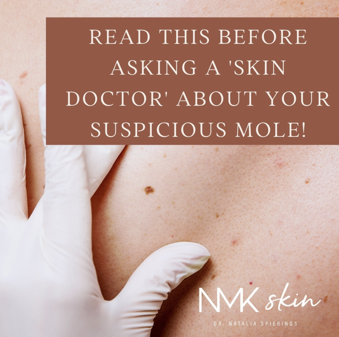 Read This Before Asking a 'skin Doctor' About Your Suspicious Mole!