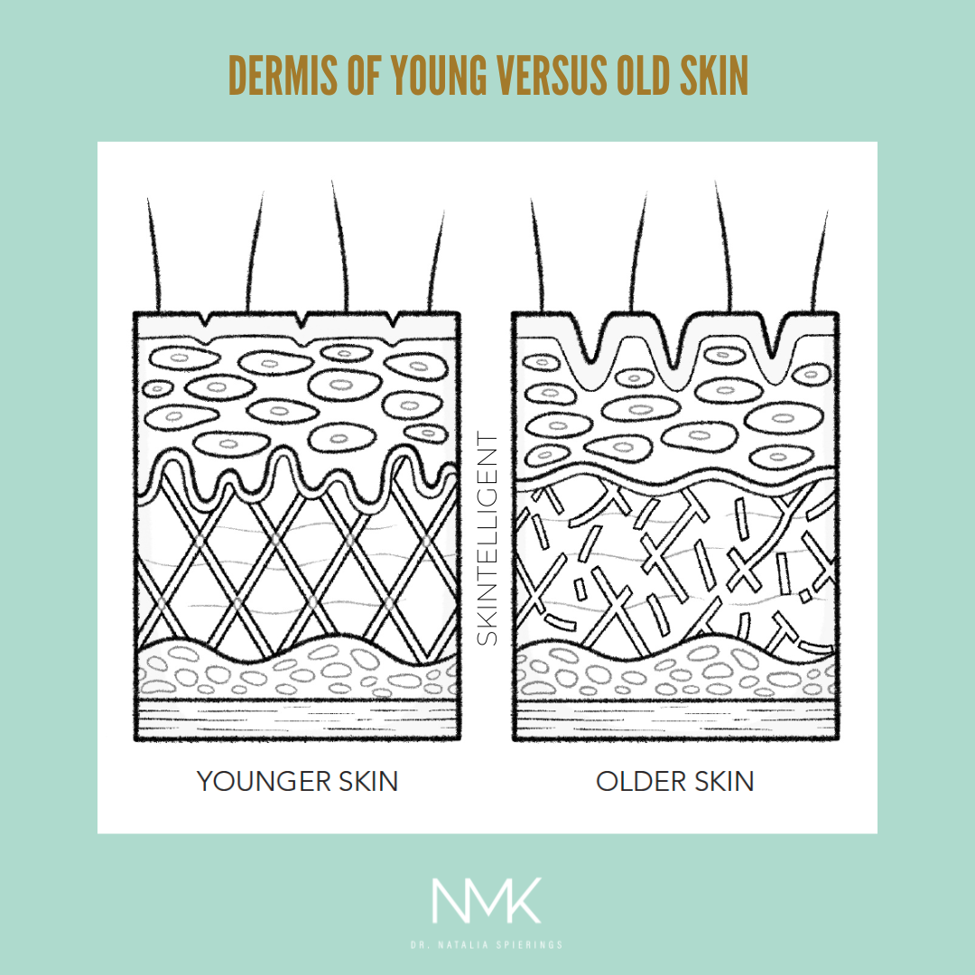 Dermis of young vs old skin