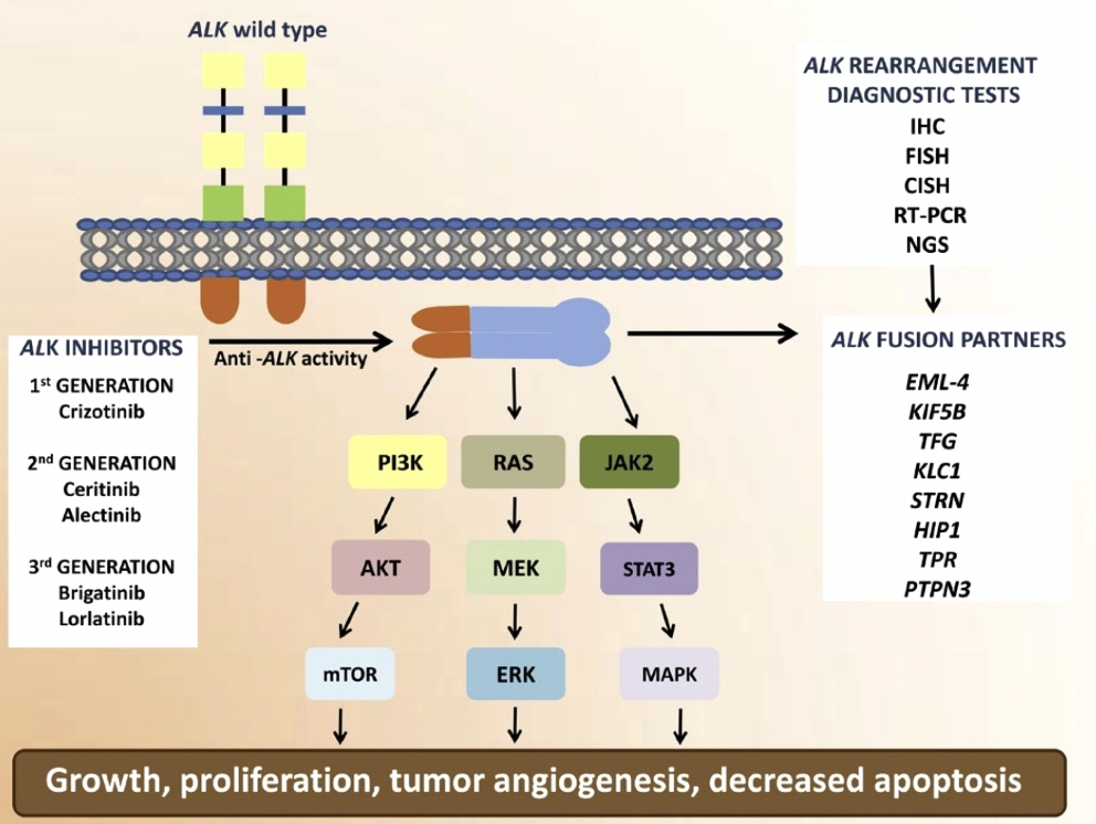 What Exactly is ALK Positive Lung Cancer? — ALK POSITIVE