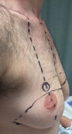 Patient C