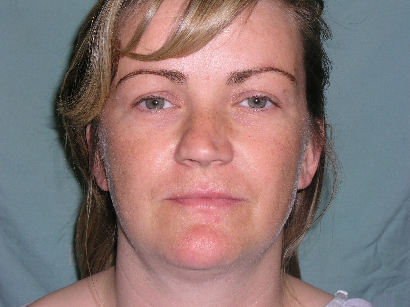 Patient D- Archived Image