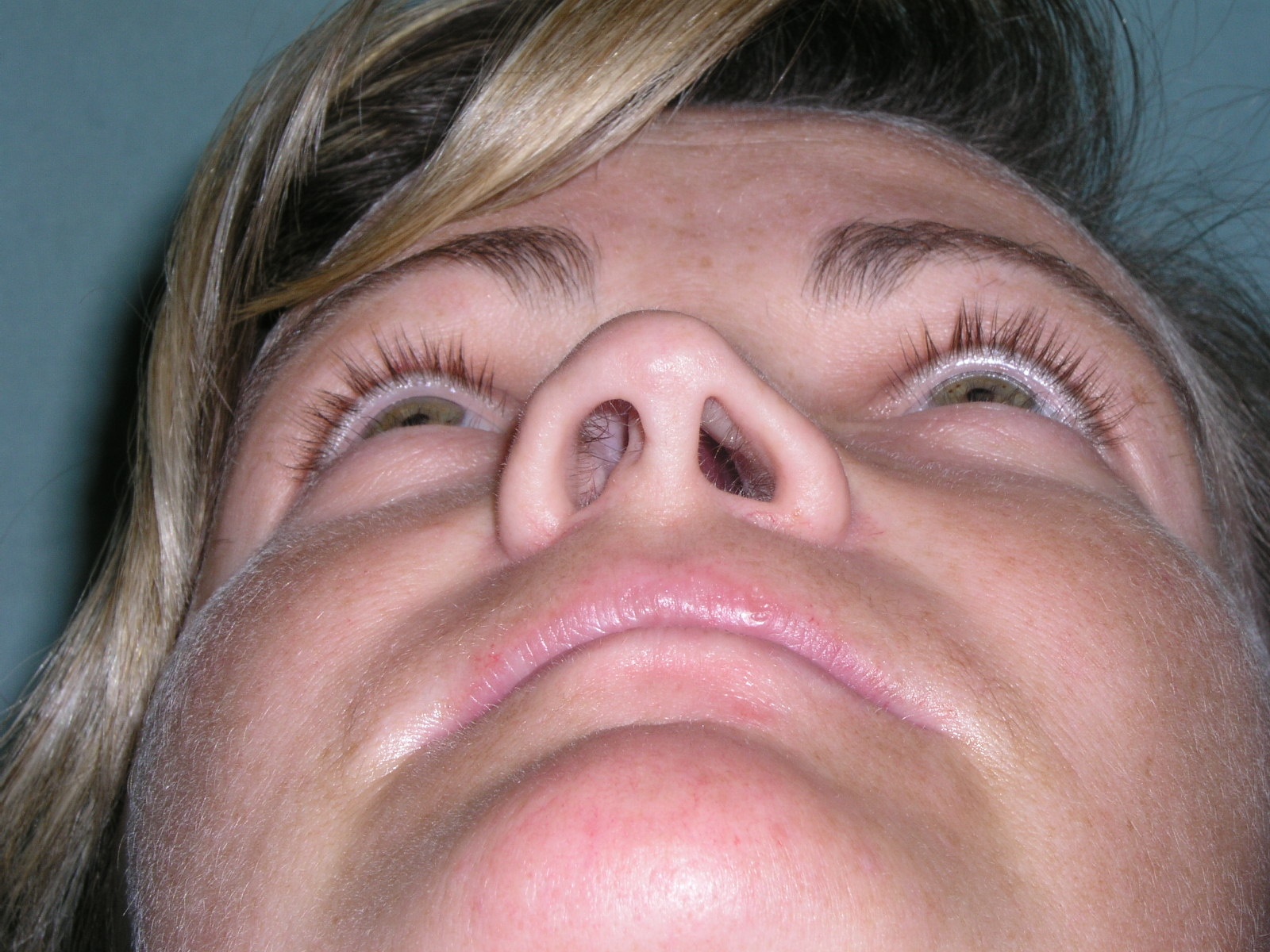 Patient D- Archived Image