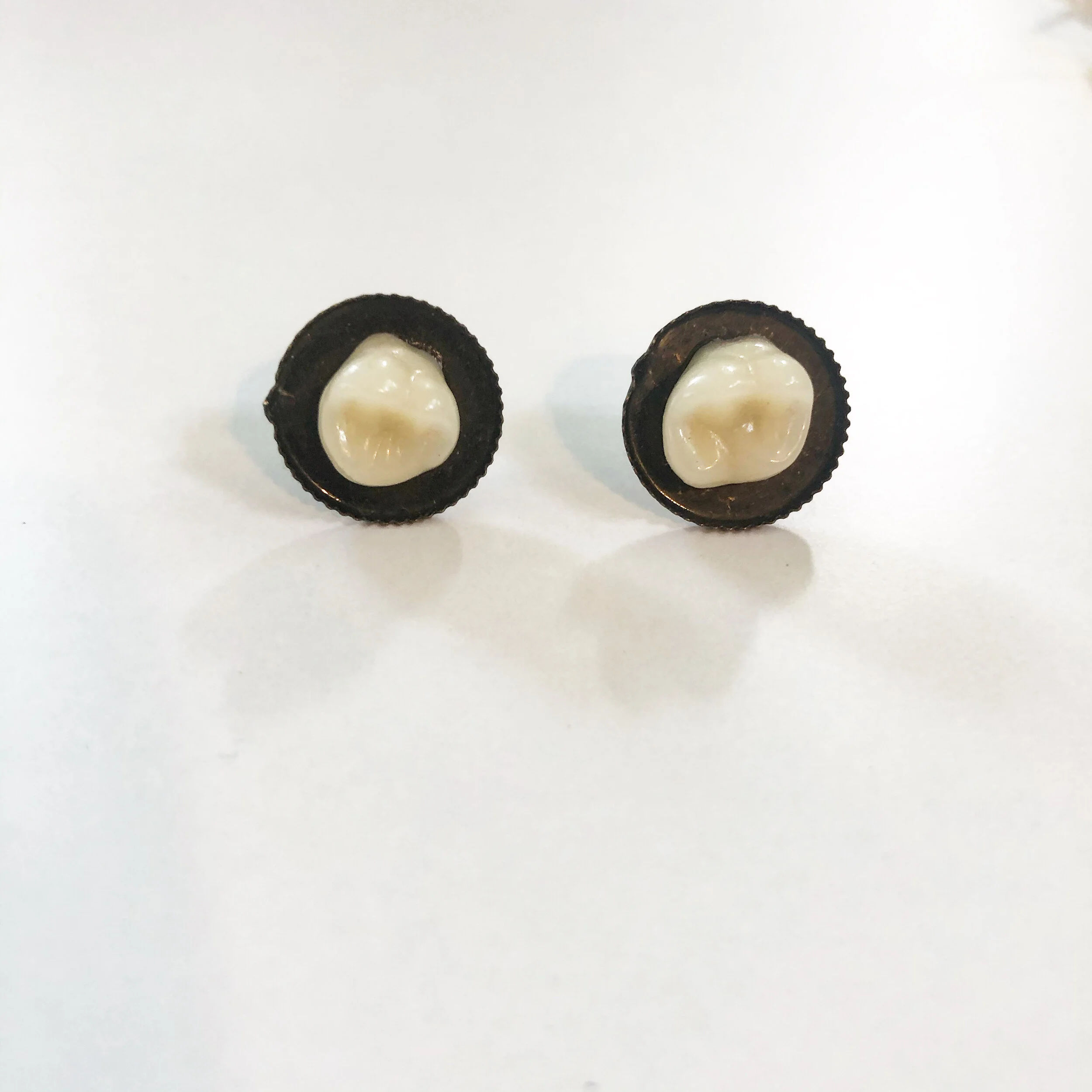 Denture Studs