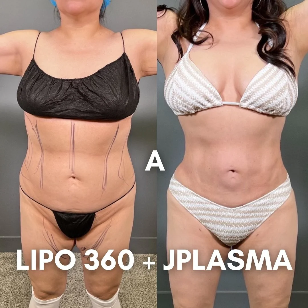 Which patient do you relate to the most!? We take all different shapes and sizes here at The Glow and help you look like the best version of yourself! 

✨Are you ready to start your journey? We offer free virtual and in person consults. To get schedu